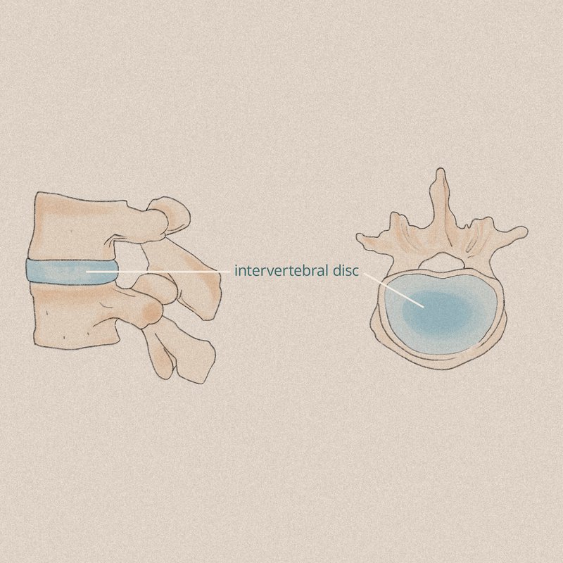 Intervertebral Discs